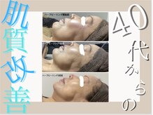 ア クイーユ(Accueil)/40代からの気になる年齢肌に！