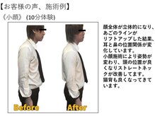 江坂回復アップラボ/お客様の声、施術例