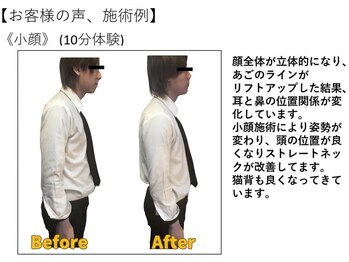 江坂回復アップラボ/お客様の声、施術例