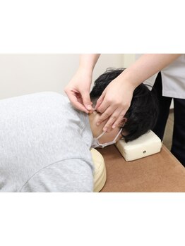鍼灸施術を受けたい
