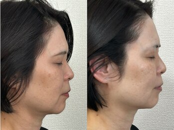 モモラ(Spa MoMora)/効果実感！ 港区白金台