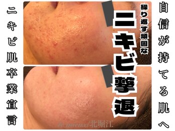 ル ミュー 堀江店(le mieux)