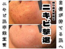 ル ミュー(le mieux)