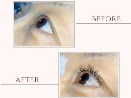 シャイン(shine)の写真