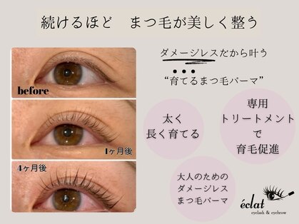 エクラ(eclat)の写真