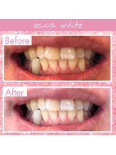 エクシアホワイト 倉吉店(ecxia white)/ビフォーアフター