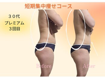 ヨサパーク リボーン(YOSA PARK Reborn)/劇的ビフォーアフター/痩身駒込