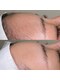 リュール(Lueur)の写真/お肌の黒ずみ・角質に徹底ケア◎シェービングで透明感UP♪前撮りや挙式を控えた花嫁様にも人気の個室サロン