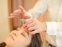 サンソ 三田店(sanso)/鍼灸メニュー