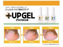 スティムネイル(Stimu nail)の雰囲気（巻き爪の方もフットジェルを楽しめます♪）