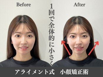 アライメントトウキョウ 表参道(Alignment TOKYO)/大きさの改善♪