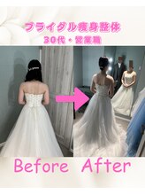 リリーフ(Re:lief)/ブライダル痩身整体