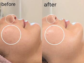 シャリル(charire)