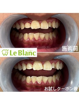ルブラン 奈良店(Le Blanc)/ライフスタイルに合った通い方!