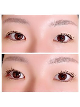 ラピヌ(Lapine)/【アップフォースリフト】