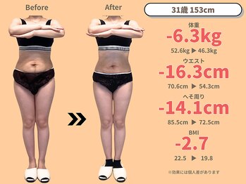 ニドム/31歳　-6kg産後痩身ダイエット1