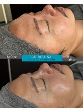 ケア(CARE)/男性フェイシャル