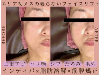 スリーム(S-urimu)/最新マシン&極上手技