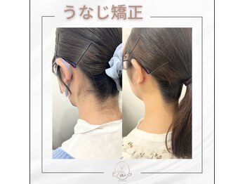 ミース 久留米店/うなじ脱毛体験1回目！
