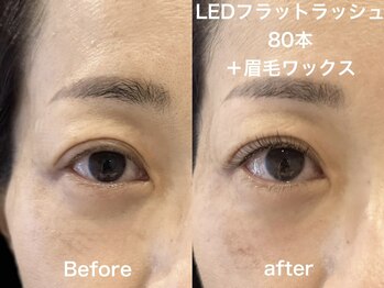 ライラック 二子玉川(Lilac)/LEDフラットラッシュ+眉毛