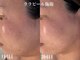 ソエル(Soel)の写真