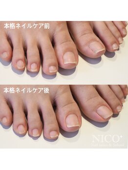 ニコプラス(NICO+)/足のお手入れできていますか?