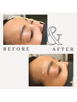 ヴォンリュクス(Von Luxe)/ハリウッドブロウリフト眉毛ケア