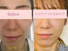 サクラ(SAKURA)/オーナー自身が小顔効果を実感