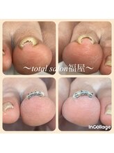 福屋/巻き爪ケアもお任せ♪