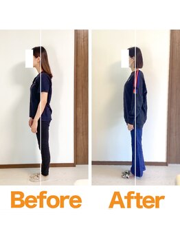 整体院ひなた 都城院/猫背反り腰改善し腰痛肩こり解消