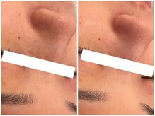 メゾンリュバン 梅田店(Maison Ruban)/ララピール・水玉リフティング