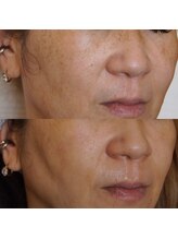 ザ シー タイムレスビューティ(THE SHE)/40代お客様症例写真