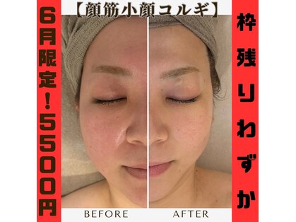 エムボーテ 太田店(M BEAUTE33)の写真