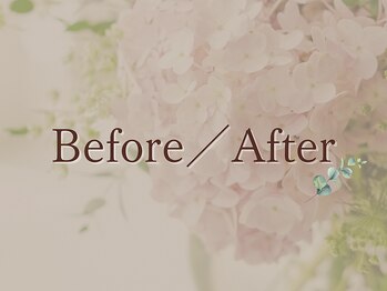 ヨサパーク ミューズ(YOSA PARK MUSE)/見た目痩せ★ Before/After