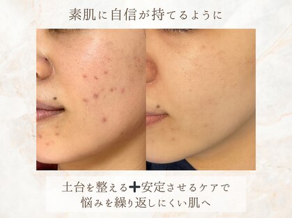 ミリアージュ(Miliage)の写真