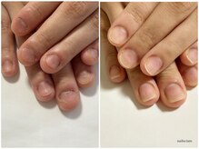ネイルズシアムの雰囲気（長年悩んでいた深爪も、別人のように）