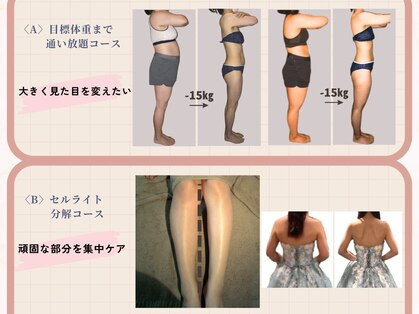 ビューティースリム リボーン 銀座店(reborn)の写真