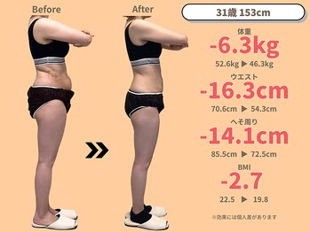 ニドム/31歳　-6kg産後痩身ダイエット2