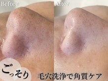 シュシュ(chou chou)