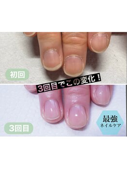 プチリリィ(Petit Lily)/すらっとした爪になれます！