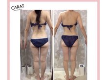 カラット(CARAT)/お客様のビフォーアフター一例