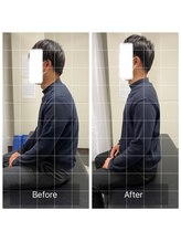 ナオル整体 浅草院(NAORU整体)/30代男性【猫背からの変化】