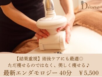 ディオネ