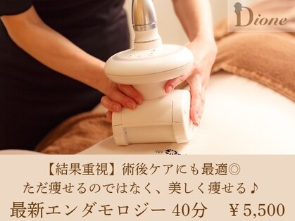 ディオネの写真