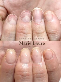 マリーロール 淀屋橋本店(Marie Laure)/自爪育成/深爪矯正/ネイルケア