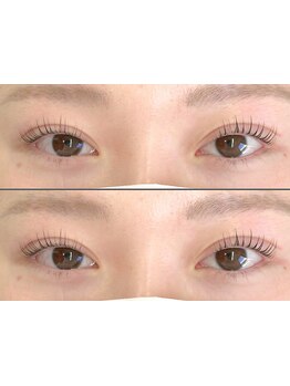 まつげのお悩み解決サロン