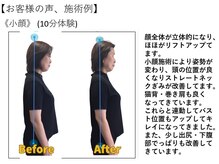 江坂回復アップラボ/お客様の声、施術例