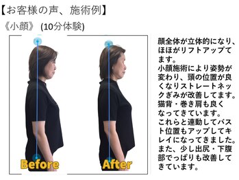 江坂回復アップラボ/お客様の声、施術例