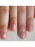 【縦長美爪になれる◎】丸い爪・平たい爪も健康的で美しい指先に