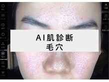 ホッコリ 段原店(HOKKORI)/AI肌診断～毛穴～